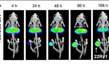 Image courtesy of Bobba, K.N., et al., Evaluation of cerium/lanthanum-134 as a PET imaging theranostic pair for 225Ac alpha radiotherapeutics. Journal of Nuclear Medicine 64, 7 (2023). Radiopharmaceuticals based on cerium/lanthanum-134 have promise for prostate cancer imaging and therapy. At right, tumors show high tumor uptake of cerium-134. At left, a comparison of cerium-134 and actinium-225 shows a similar pattern of uptake in most tissues (note the tumor tissue on the leg).